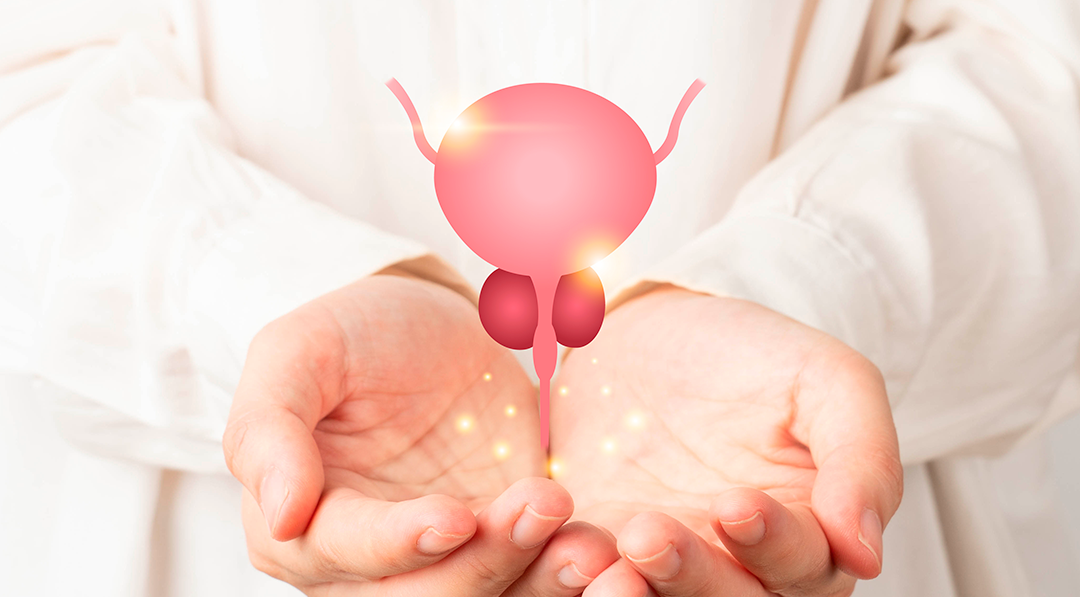 Diagnóstico e sintomas de câncer de bexiga - Dr. Leonardo Ortigara
